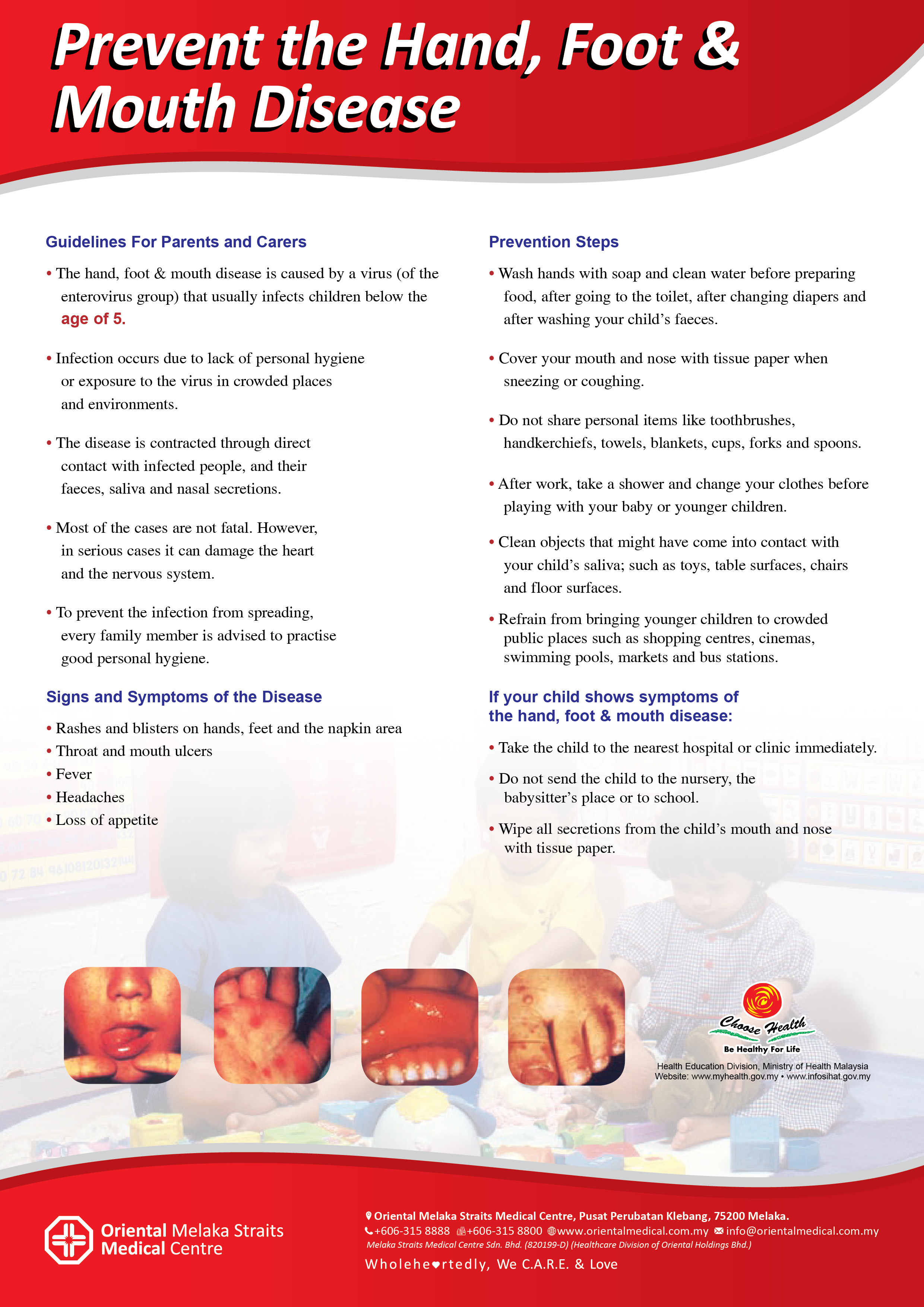 Prevent the Hand, Foot, and Mouth Disease « MELAKA STRAITS MEDICAL CENTRE